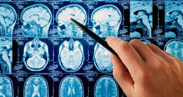 Brain Cancer Strongly Linked to Cell Phone Radiation in Brand-New, Large-Scale Study 39