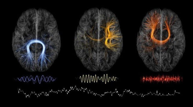 Scientists prove Your Forgetfulness Is A Sign Of Extraordinary Intelligence 1 Scientists prove Your Forgetfulness Is A Sign Of Extraordinary Intelligence